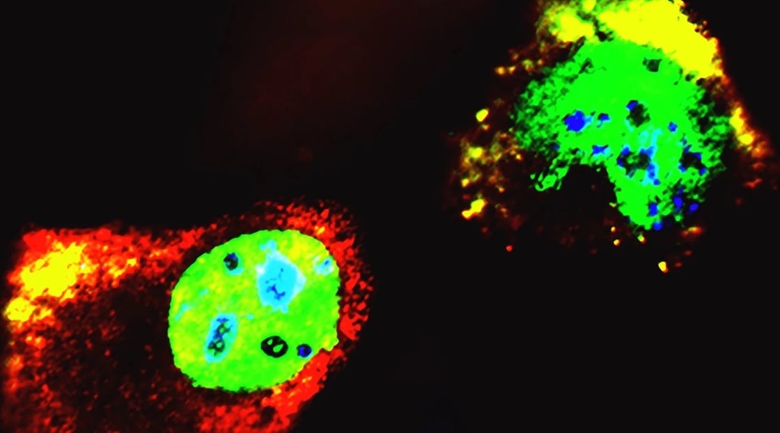 Isoforms of p53 bind to full-length p53 proteins to form aggregates, which prevents the full-length version of p53 from fighting cancer.
