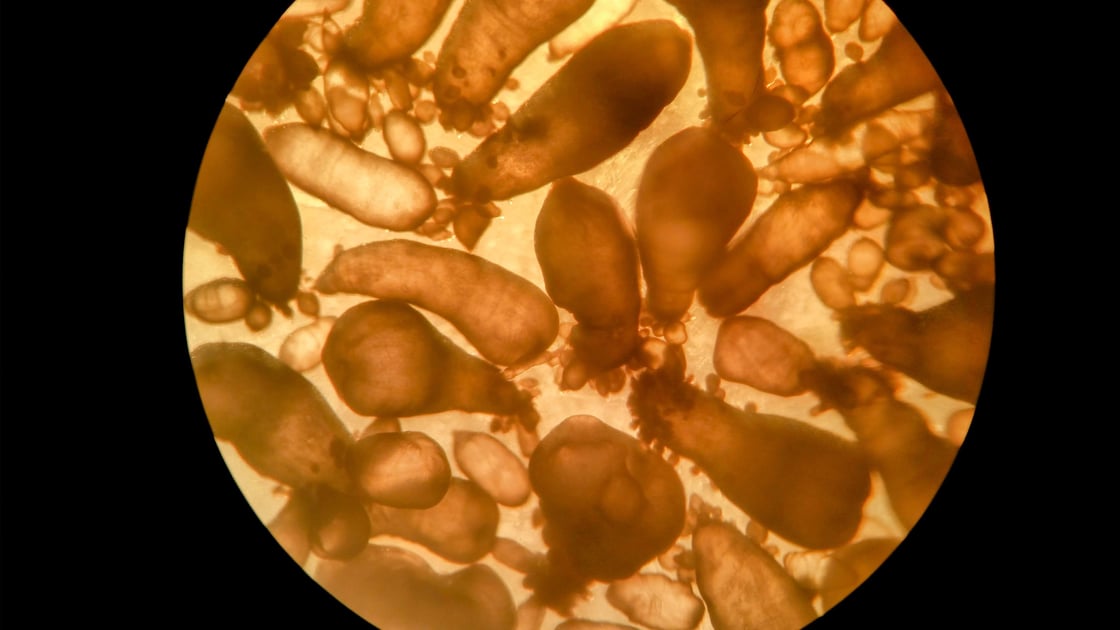 Tapeworm that causes epilepsy visualized under a microscope